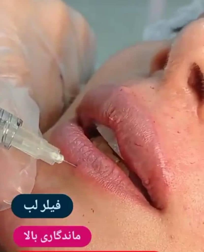 کلینیک زیبایی دکتر زهرا افراخته در کیانپارس تهران