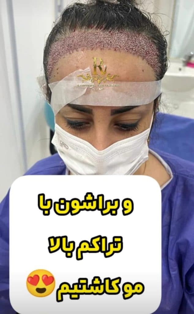 مرکز تخصصی کاشت مو رسول زاده در آبادان