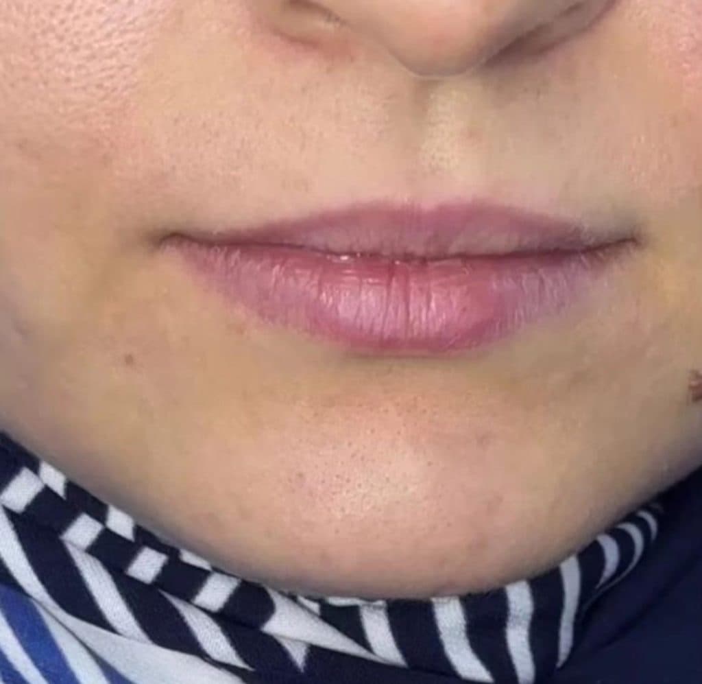 خدمات تزریق ژل و بوتاکس شرفی در کرمانشاه