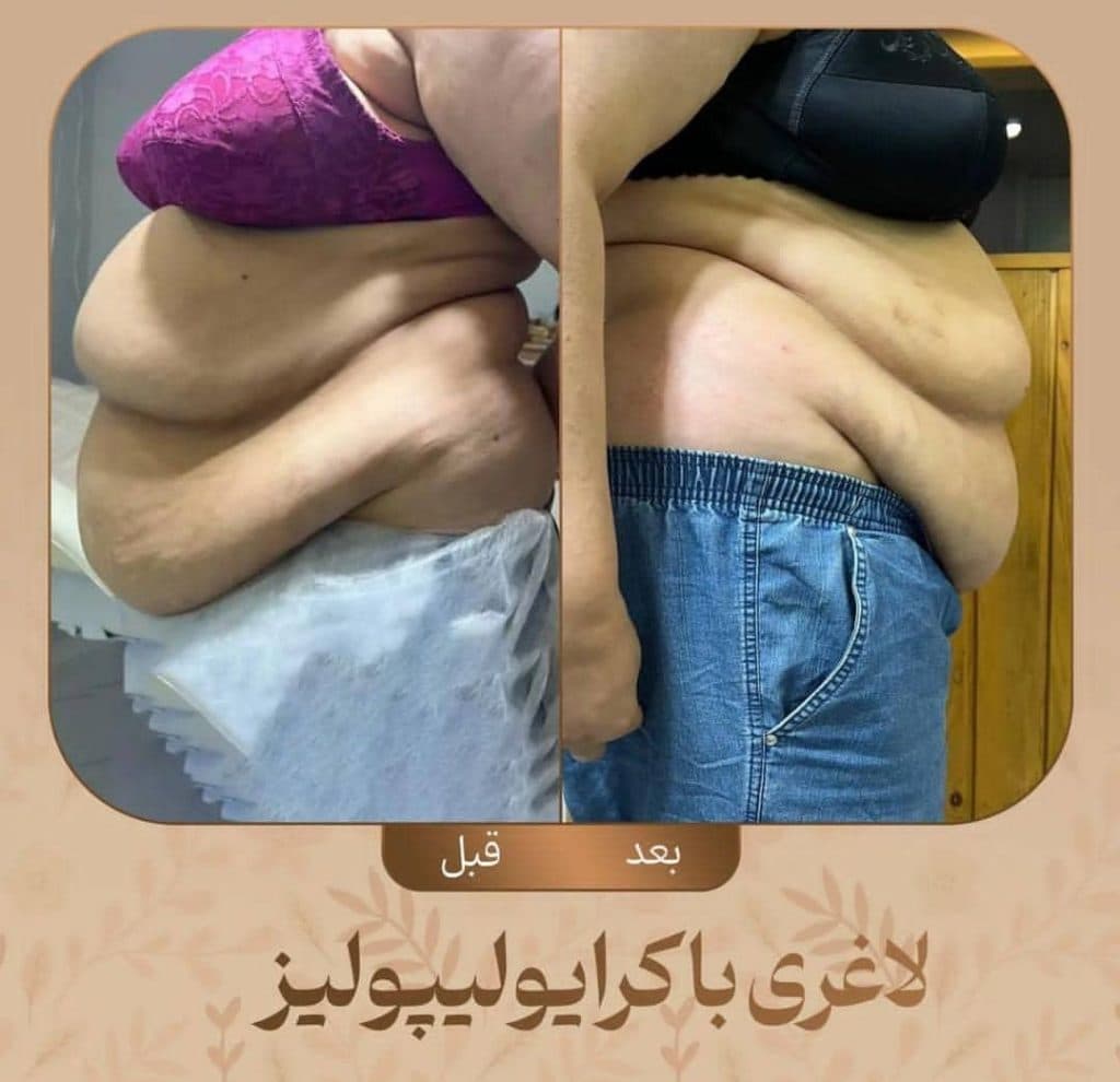 مرکز تناسب اندام و لاغری آریل دایت در مشهد