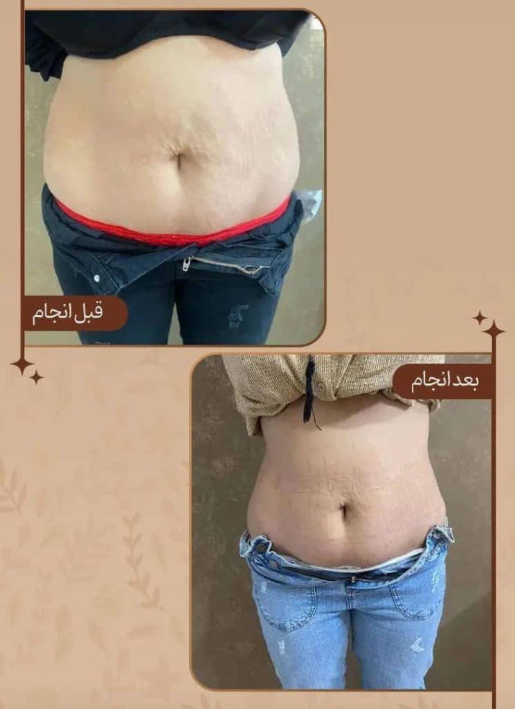 مرکز تناسب اندام و لاغری آریل دایت در مشهد