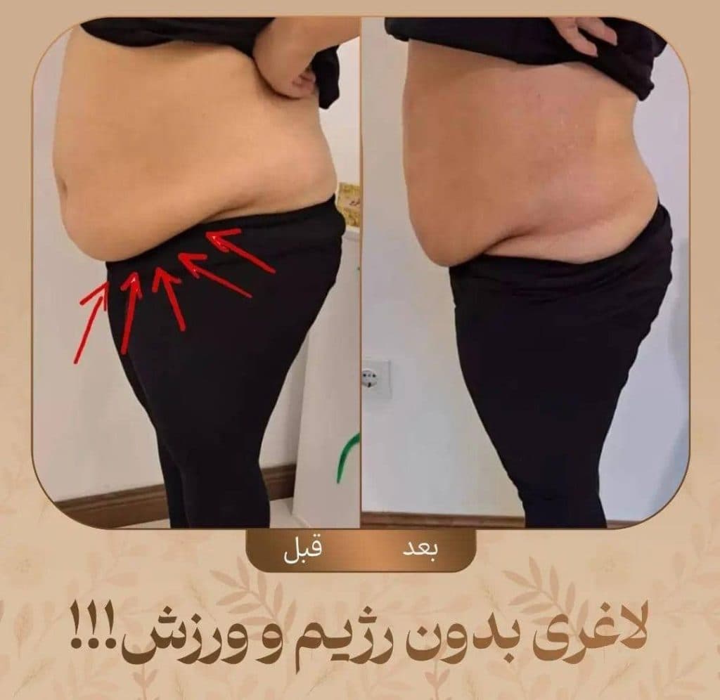 مرکز تناسب اندام و لاغری آریل دایت در مشهد