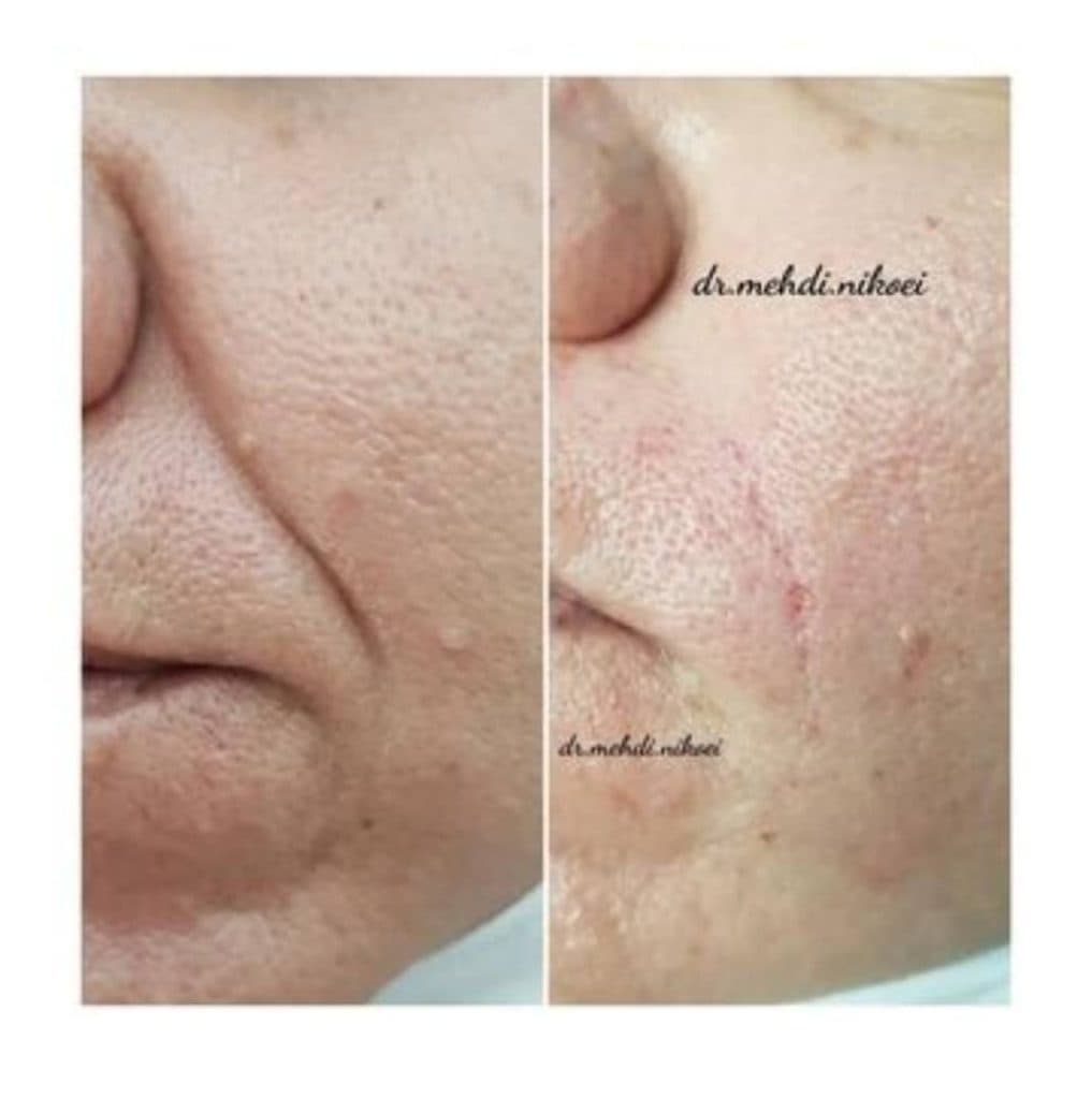 کلینیک زیبایی لیزر دکتر مهدی نیکویی در جم