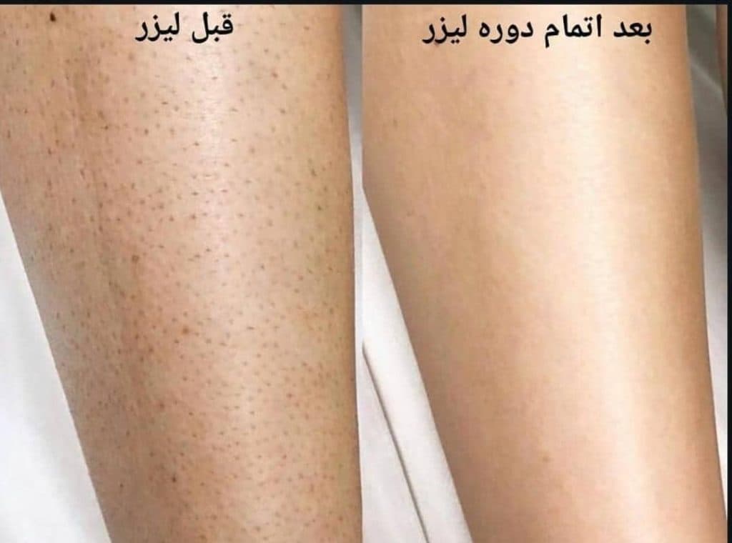 کلینیک زیبایی لیزر آبان در پرند