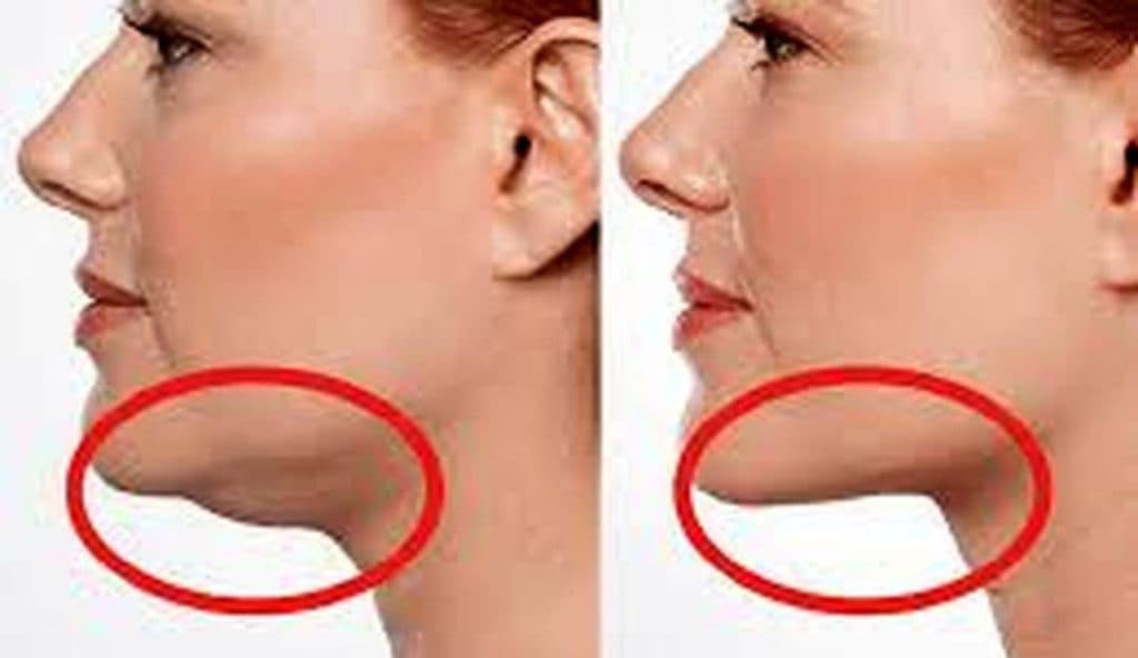 کلینیک زیبایی لیزر آبان در پرند