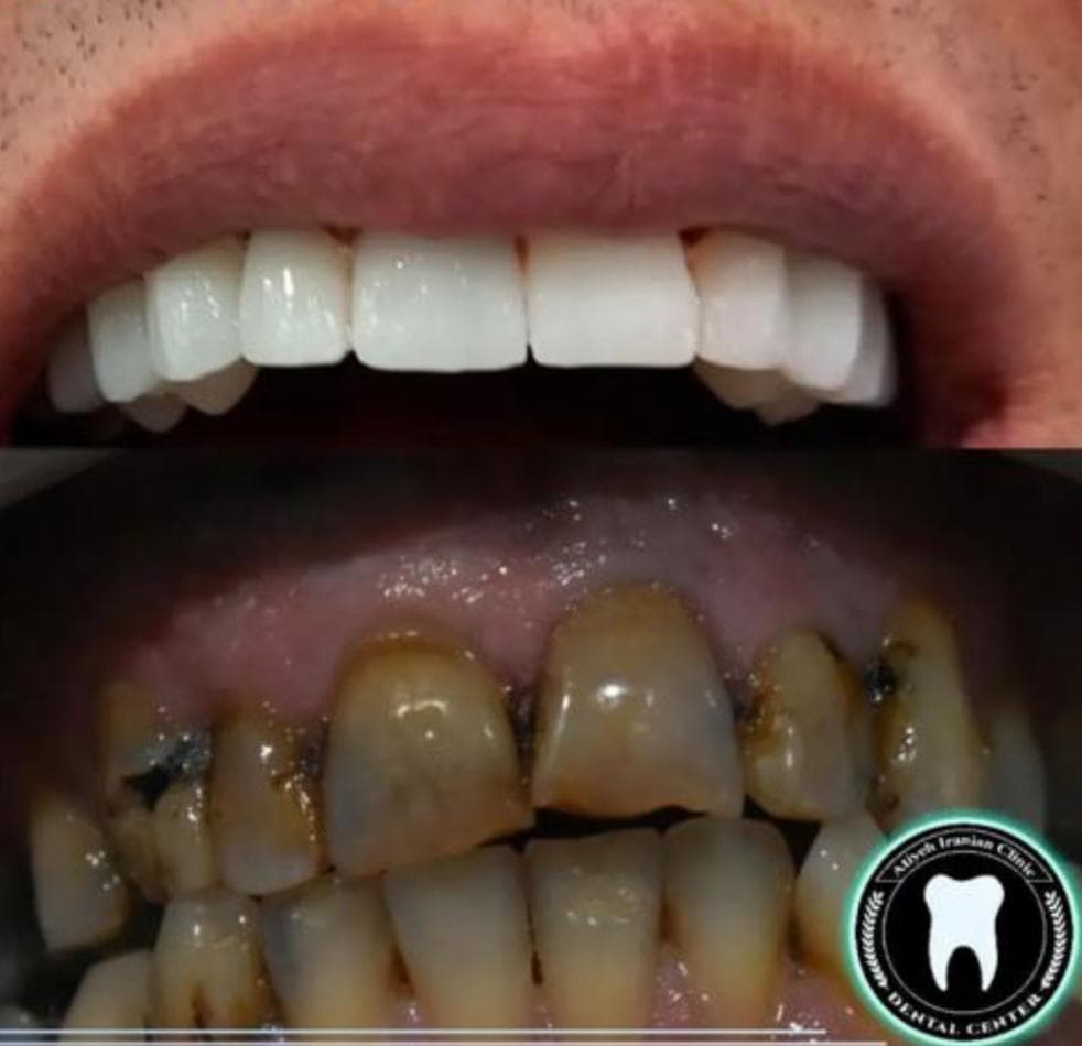 کلینیک دندانپزشکی آتیه ایرانیان در پنج آذر اصفهان