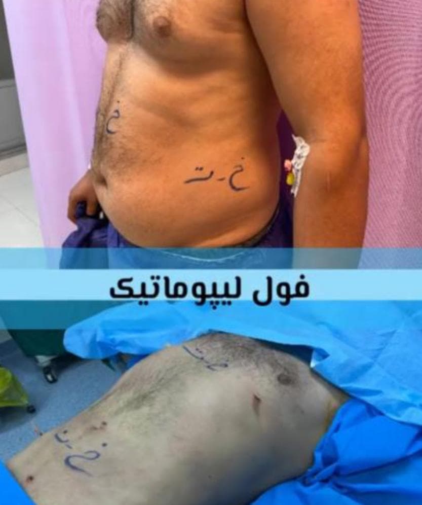 مطب زیبایی دکتر مقصودلو در دولت تهران