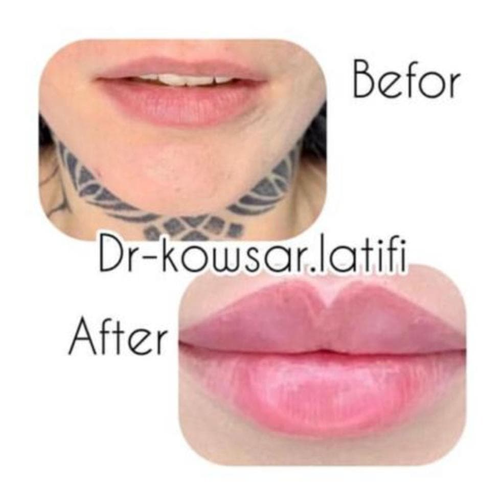 کلینیک تخصصی زیبایی آتیماه در فردوسی زاهدان