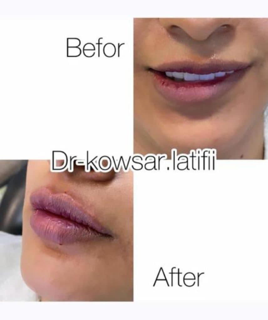 کلینیک تخصصی زیبایی آتیماه در فردوسی زاهدان