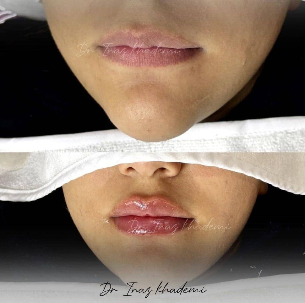 کلینیک زیبایی دکتر آیناز خادمی در تهران