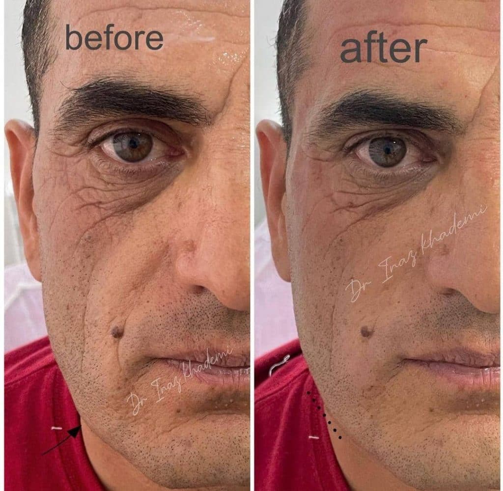 کلینیک زیبایی دکتر آیناز خادمی در تهران