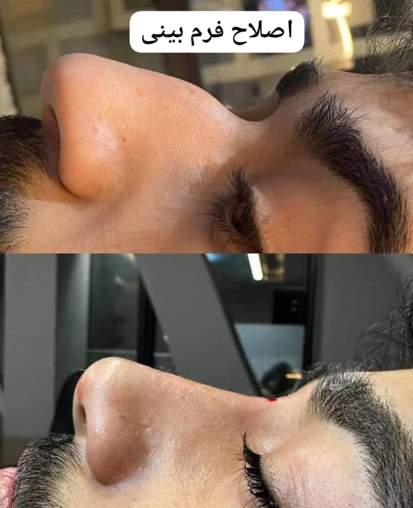 کلینیک زیبایی پوست و مو سایه در مشهد