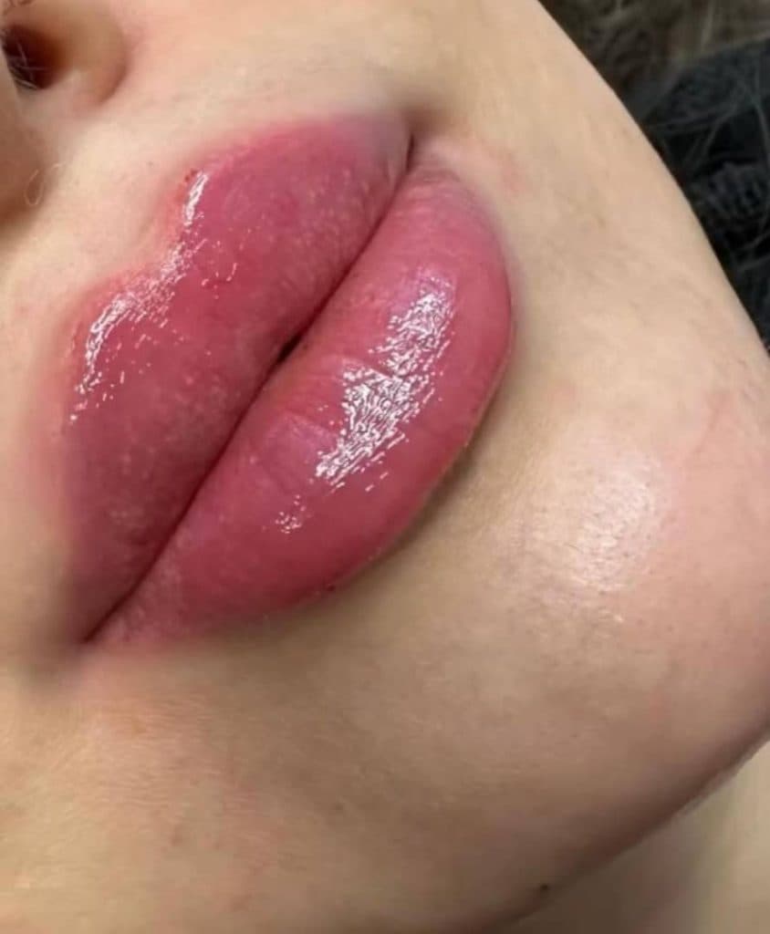 کلینیک زیبایی پوست و مو سایه در مشهد