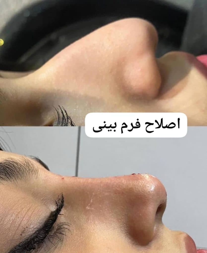 کلینیک زیبایی پوست و مو سایه در مشهد