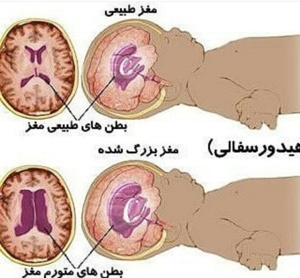 مرکز کاردرمانی مهر در بندرعباس
