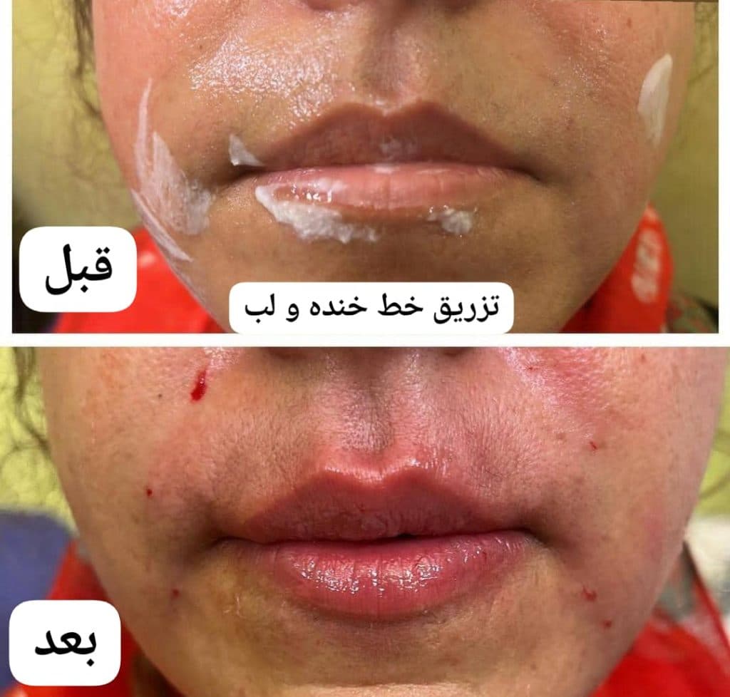 مطب زیبایی پوست و مو دکتر شهرزاد پرویزی در مشهد
