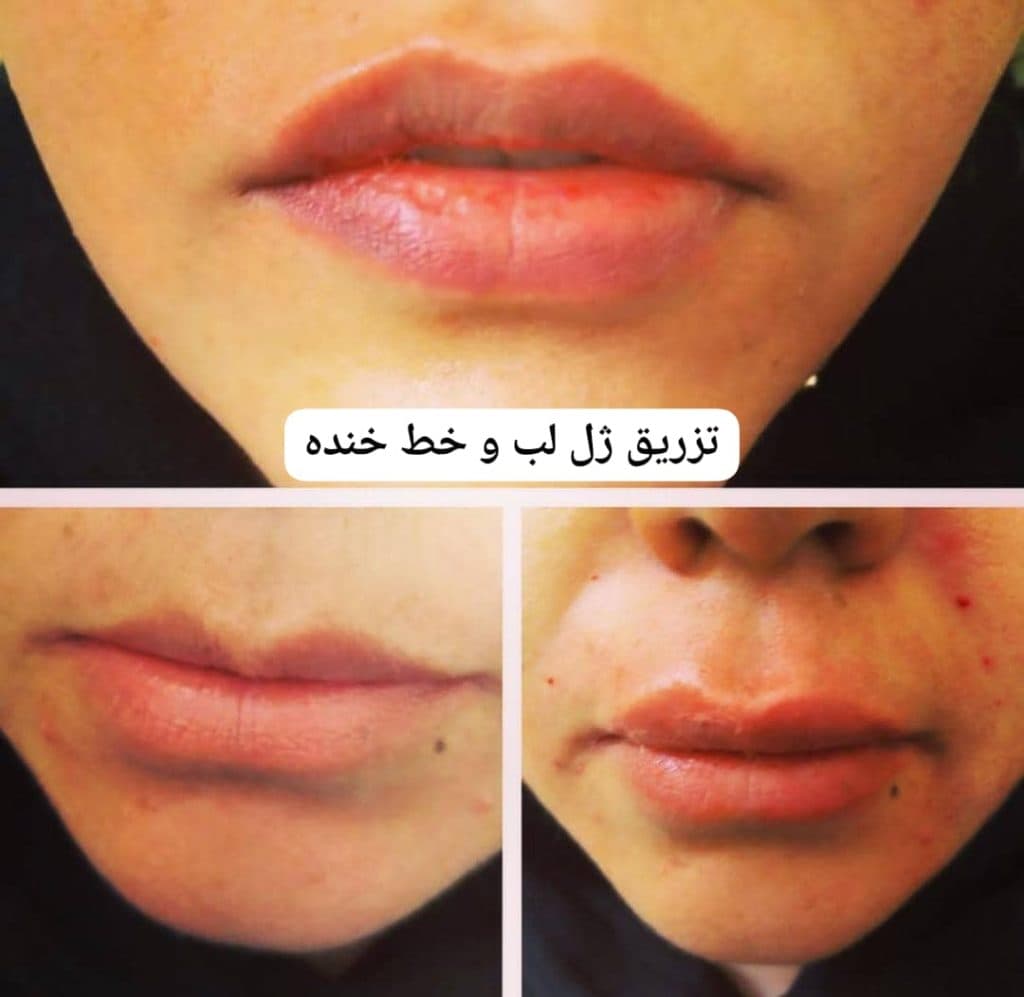 مطب زیبایی پوست و مو دکتر شهرزاد پرویزی در مشهد
