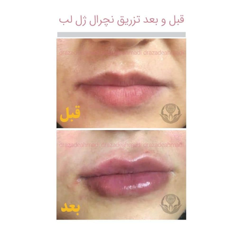 مطب زیبایی پوست و مو دکتر آزاده احمدی در مشهد