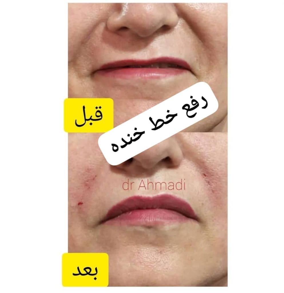 مطب زیبایی پوست و مو دکتر آزاده احمدی در مشهد