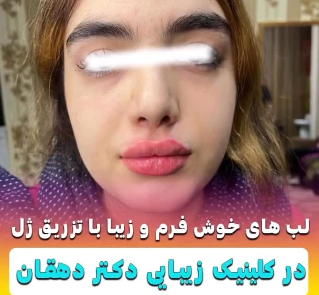 کلینیک زیبایی مانلی دکتر دهقان در مارلیک