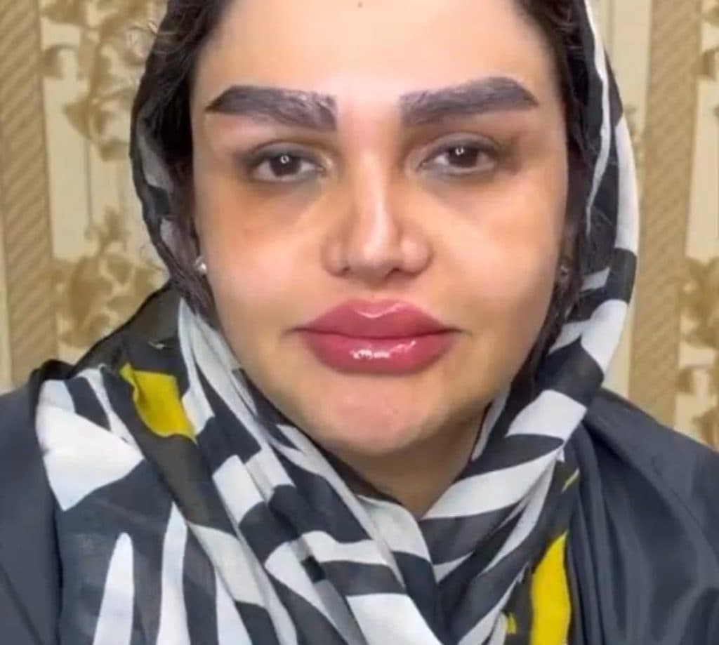 کلینیک زیبایی مانلی دکتر دهقان در مارلیک