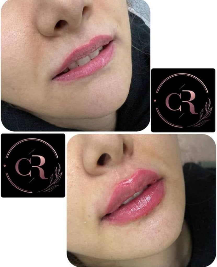 مطب زیبایی ریما در گوهردشت