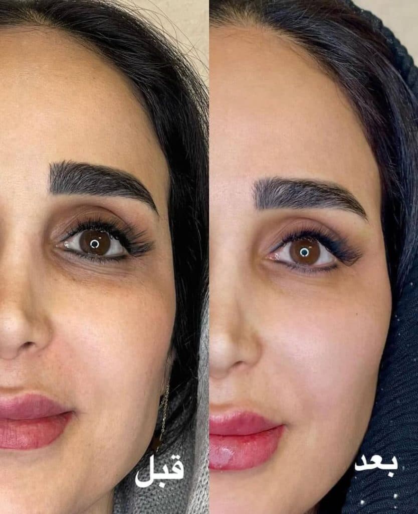 مطب پوست و مو رامان در یزد