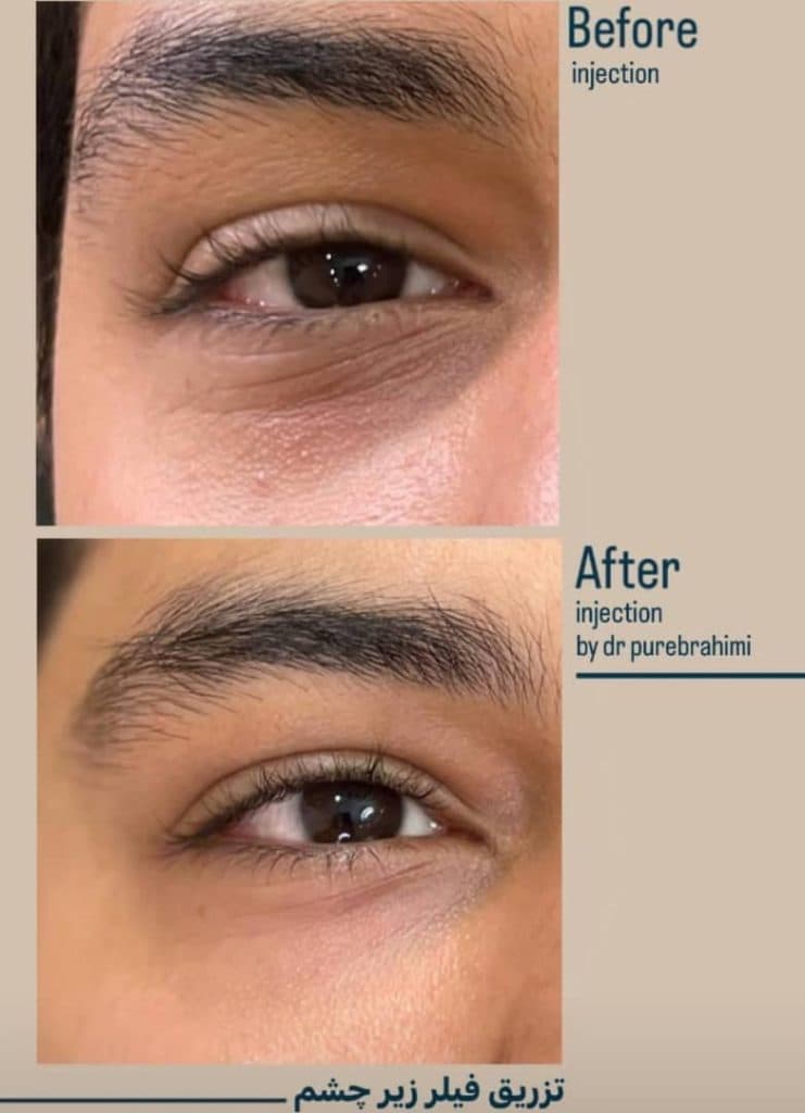 مطب پوست و مو رامان در یزد