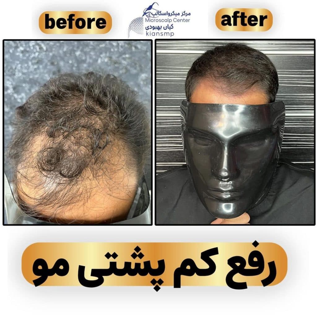 مرکز تخصصی اسکالپ کیان بهبودی در شیراز