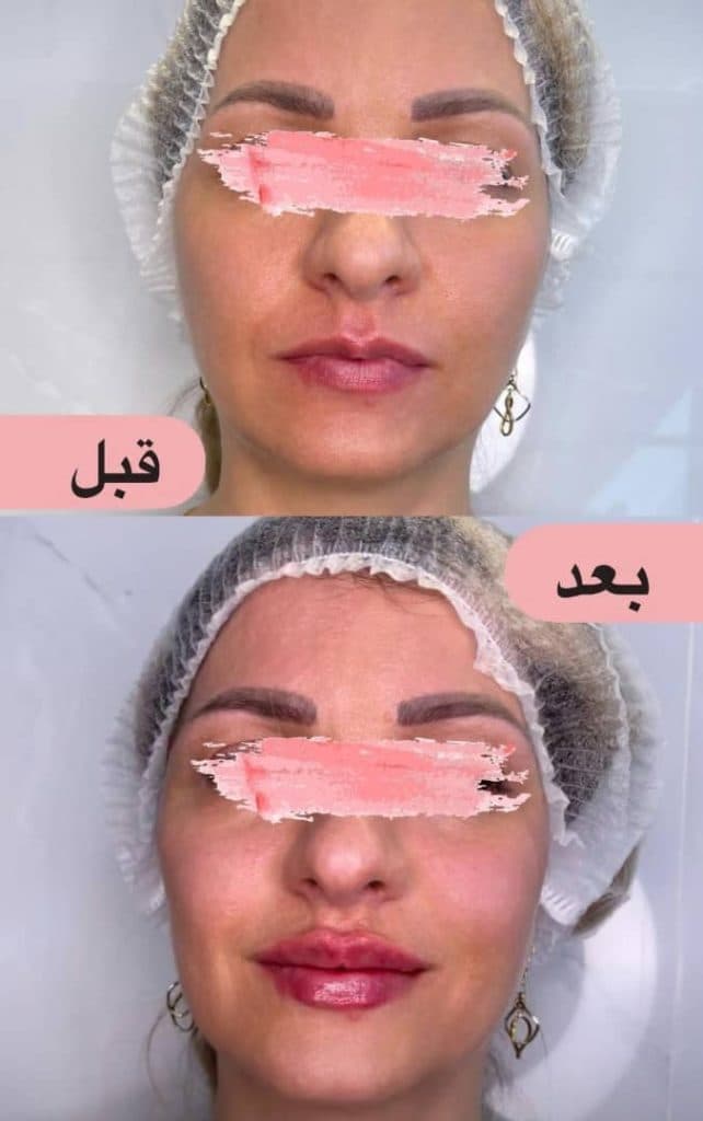 پزشک زیبایی پوست و مو دکتر عاطفه صمیمی در خمینی شهر