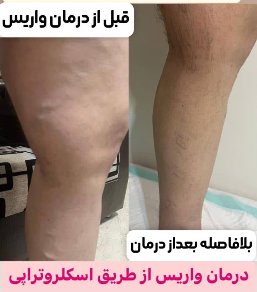 فوق تخصص قلب و عروق دکتر پیمان اشرفی در شرق تهران