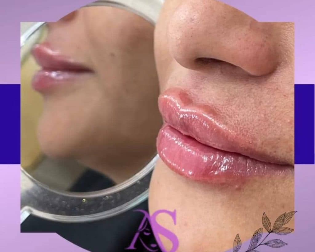 پزشک زیبایی پوست و مو دکتر عاطفه صمیمی در خمینی شهر