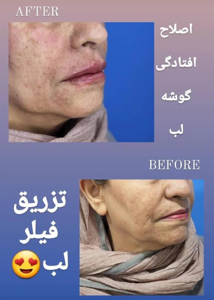جراحی زیبایی بینی و صورت دکتر سارا ارژنگ در تهران