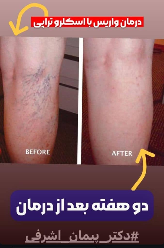 فوق تخصص قلب و عروق دکتر پیمان اشرفی در شرق تهران