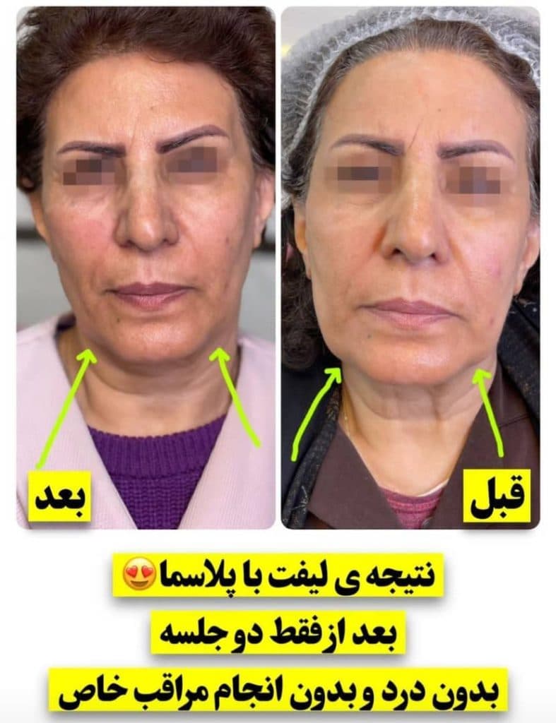 پزشک زیبایی پوست و مو دکتر عاطفه صمیمی در خمینی شهر