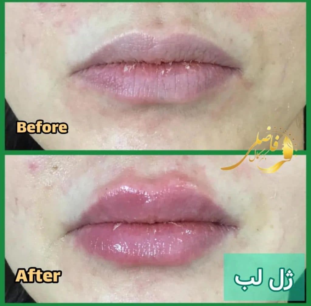 مطب زیبایی دکتر کمال فاضلی در پیروزی تهران