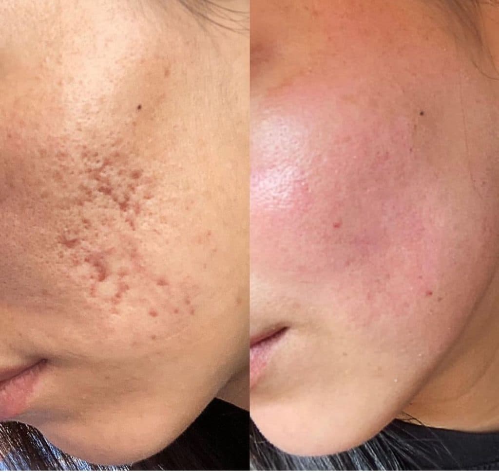 کلینیک زیبایی پوست و مو نهال در تهران