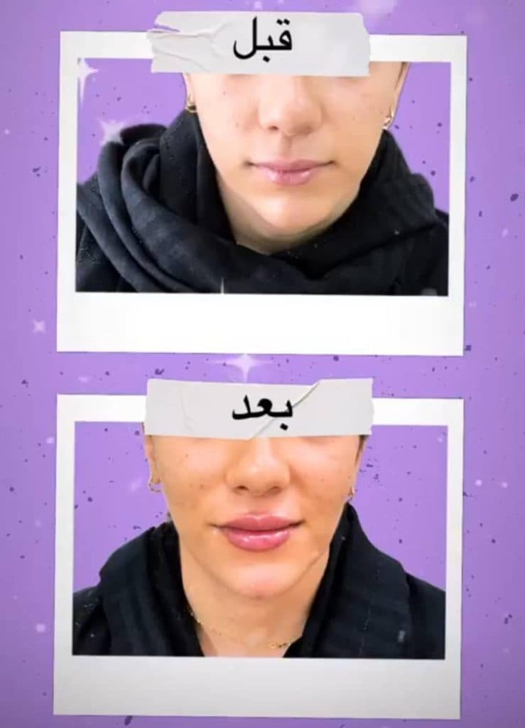 پزشک زیبایی پوست و مو دکتر عاطفه صمیمی در خمینی شهر