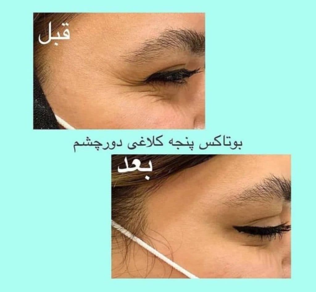 مطب زیبایی پوست و مو دکتر مریم هاشمی عطار در مشهد