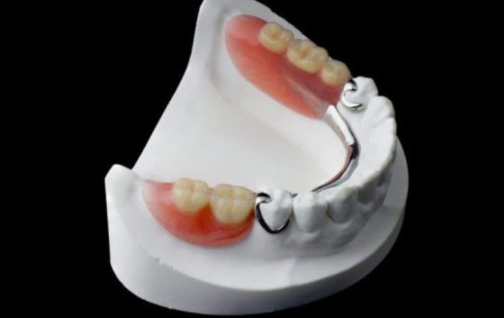 دندانسازی محبی در اسلام آباد زنجان