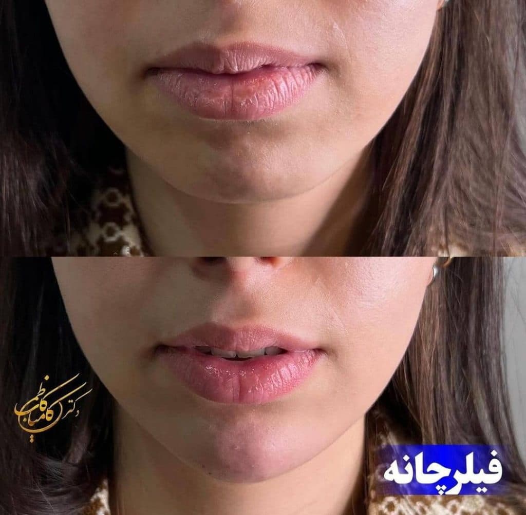 مطب زیبایی پوست و مو دکتر کامیاب کاظمی در مرودشت