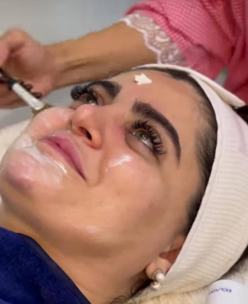 فیشال و پاکسازی پوست خاطره لک در کیانپارس اهواز