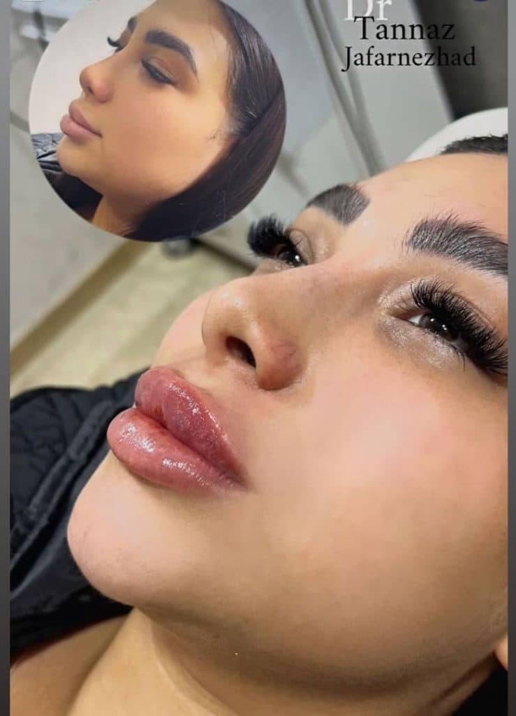 کلینیک زیبایی طناز در طالقانی کرج