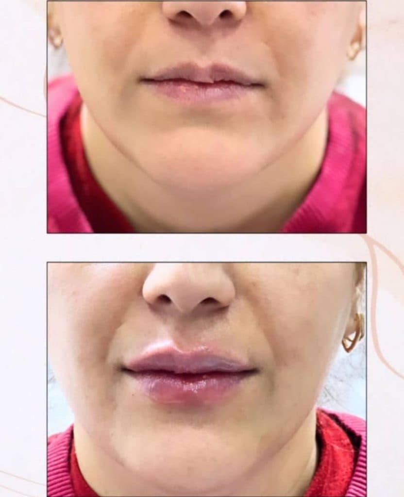 کلینیک زیبایی طناز در طالقانی کرج