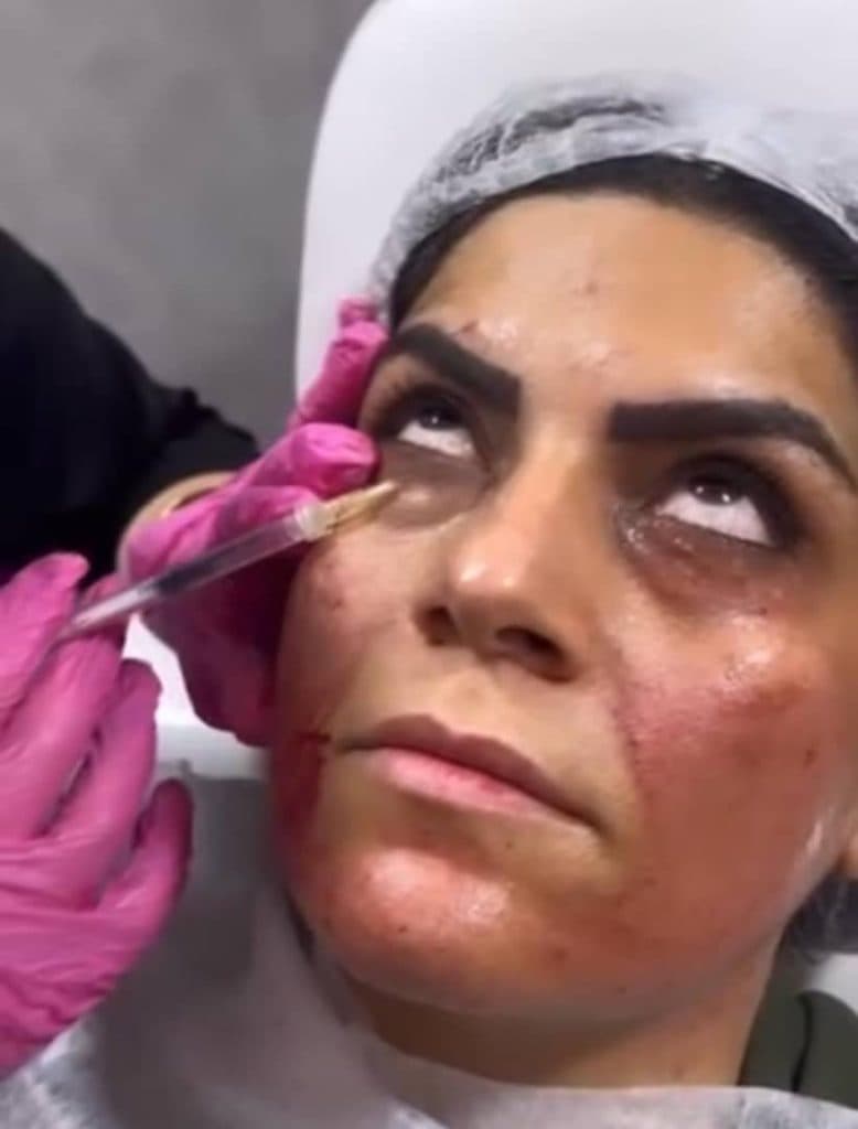 کلینیک زیبایی طناز در طالقانی کرج