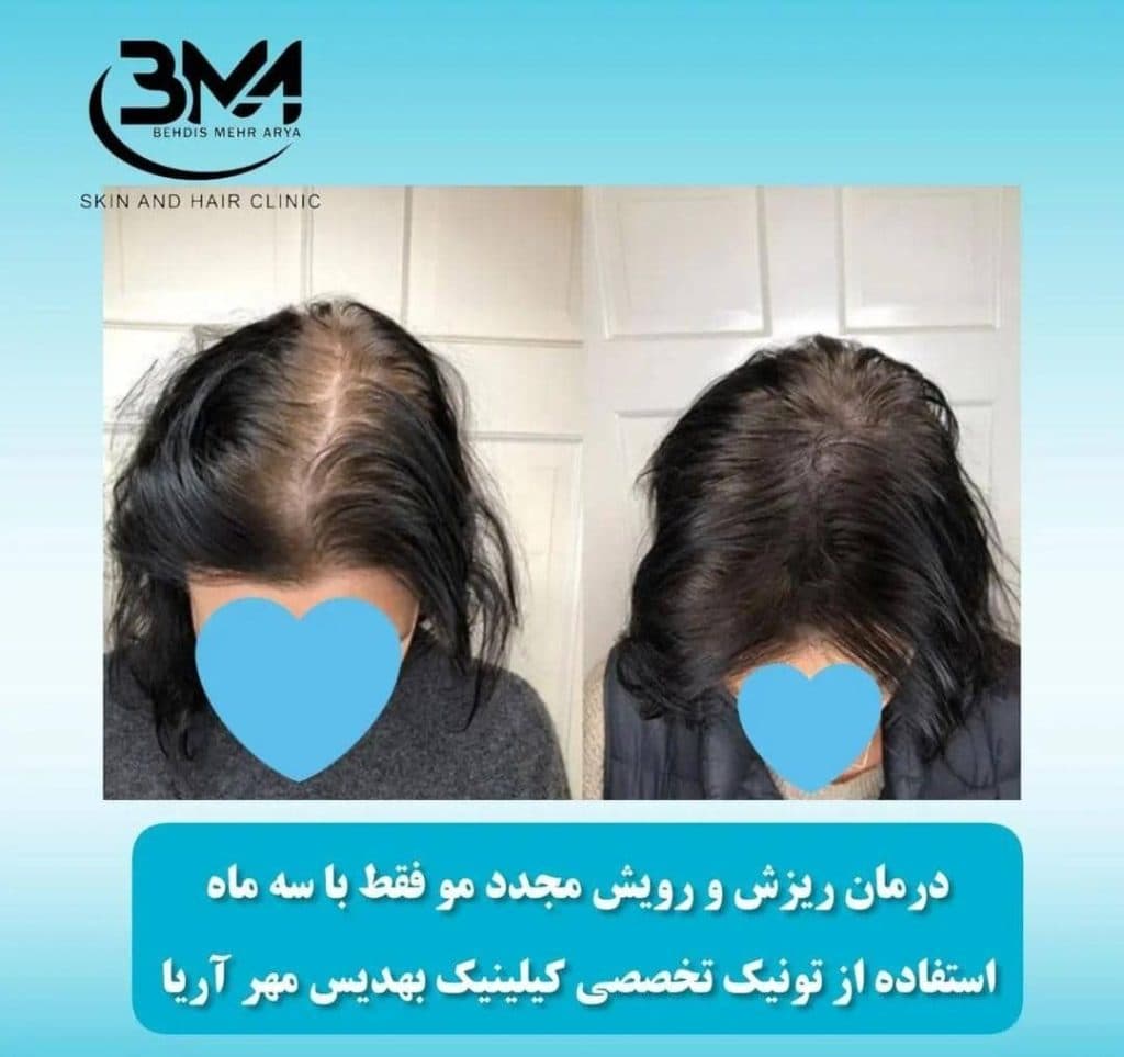 کلینیک پوست و مو بهدیس مهر آریا در اصفهان