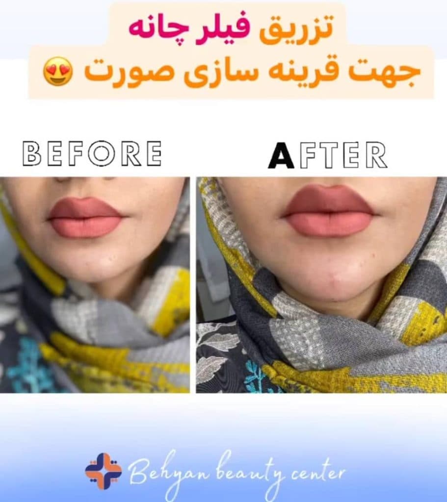 کلینیک زیبایی پوست و مو بهیان در خرم آباد