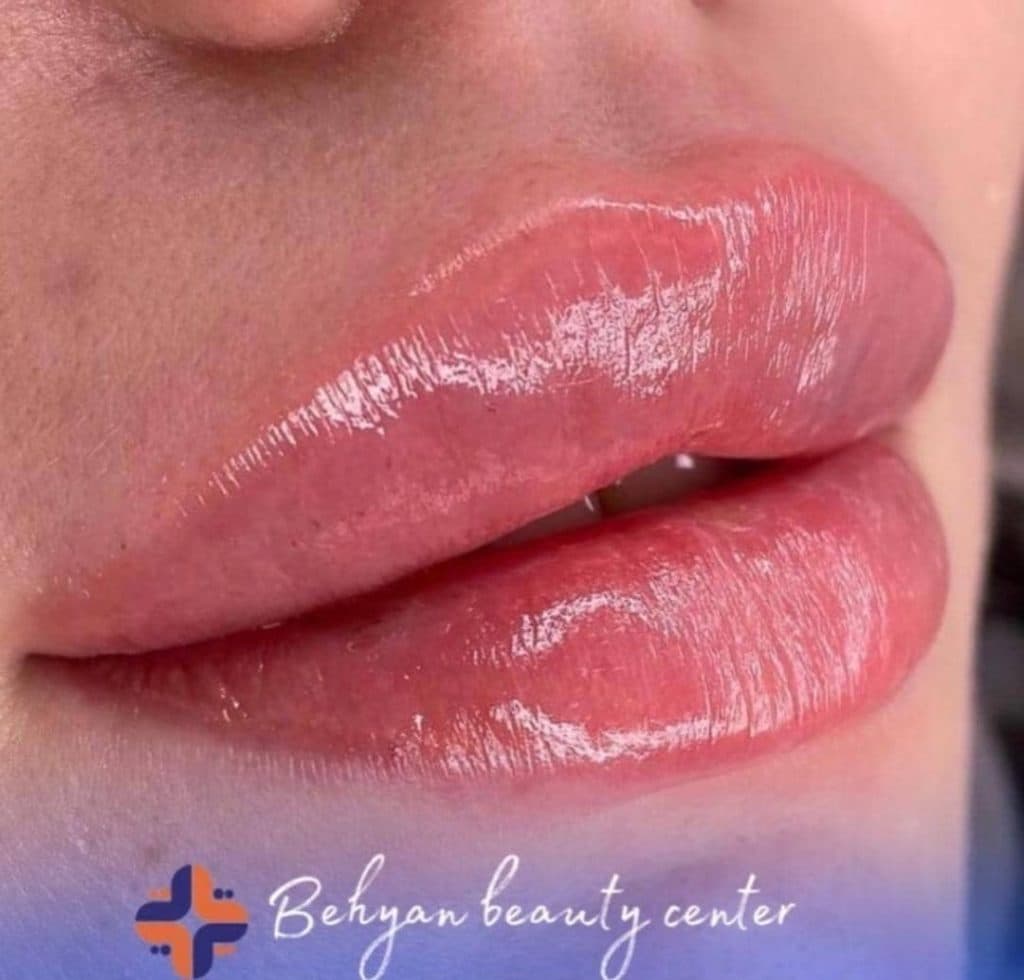 کلینیک زیبایی پوست و مو بهیان در خرم آباد