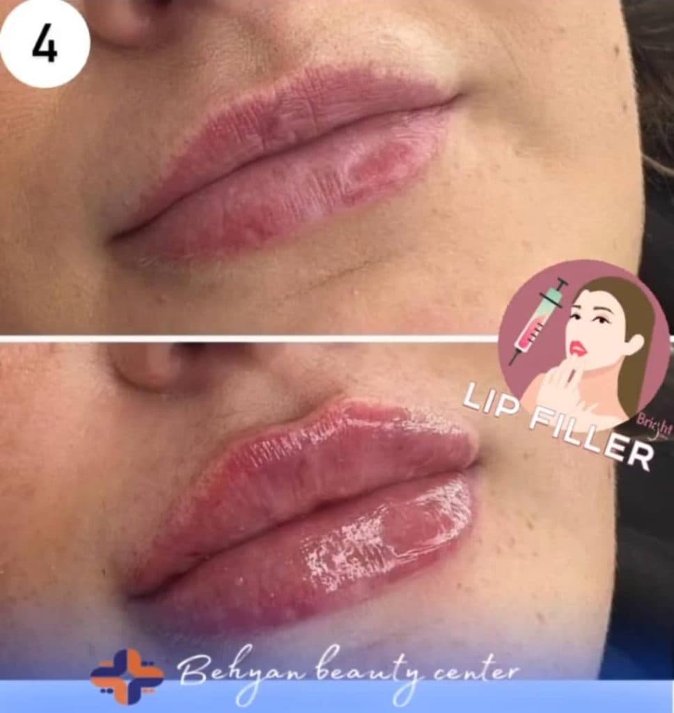 کلینیک زیبایی پوست و مو بهیان در خرم آباد