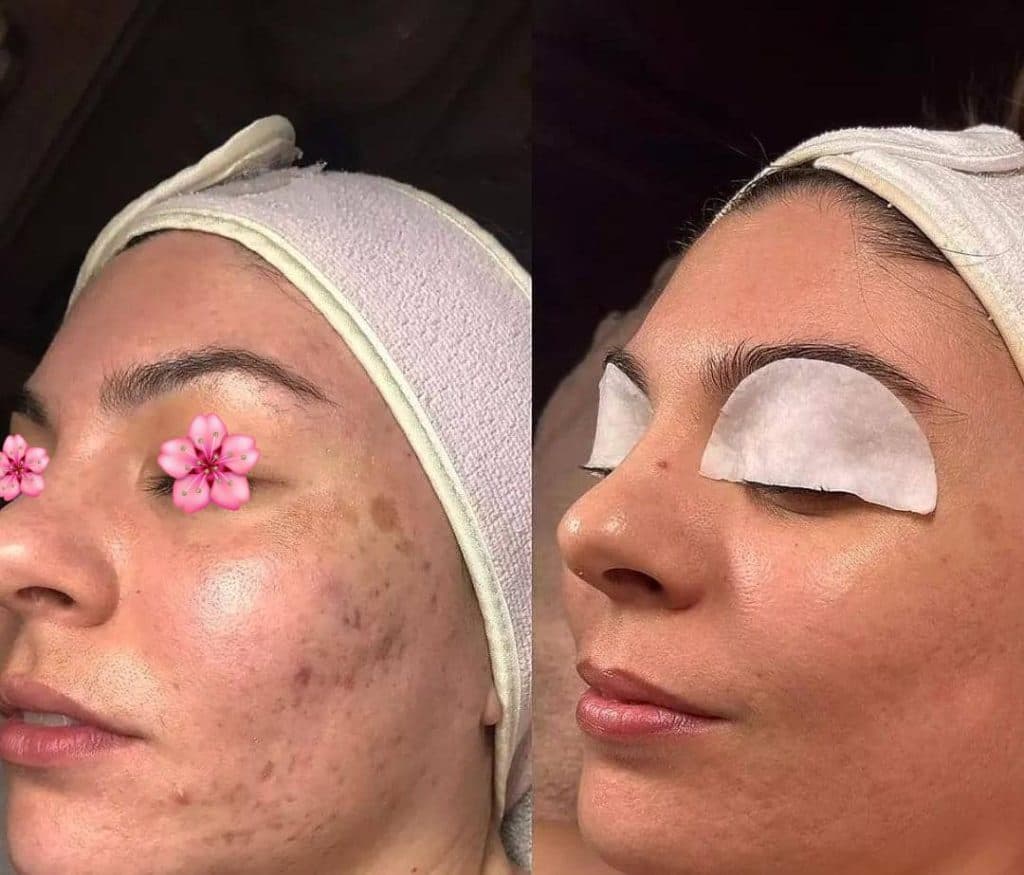 کلینیک زیبایی پوست و مو نهال در تهران